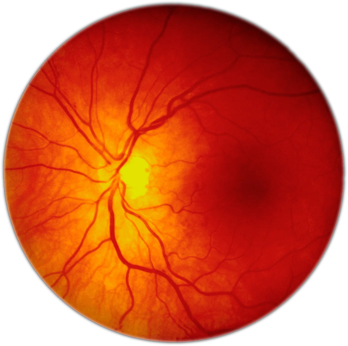 retina