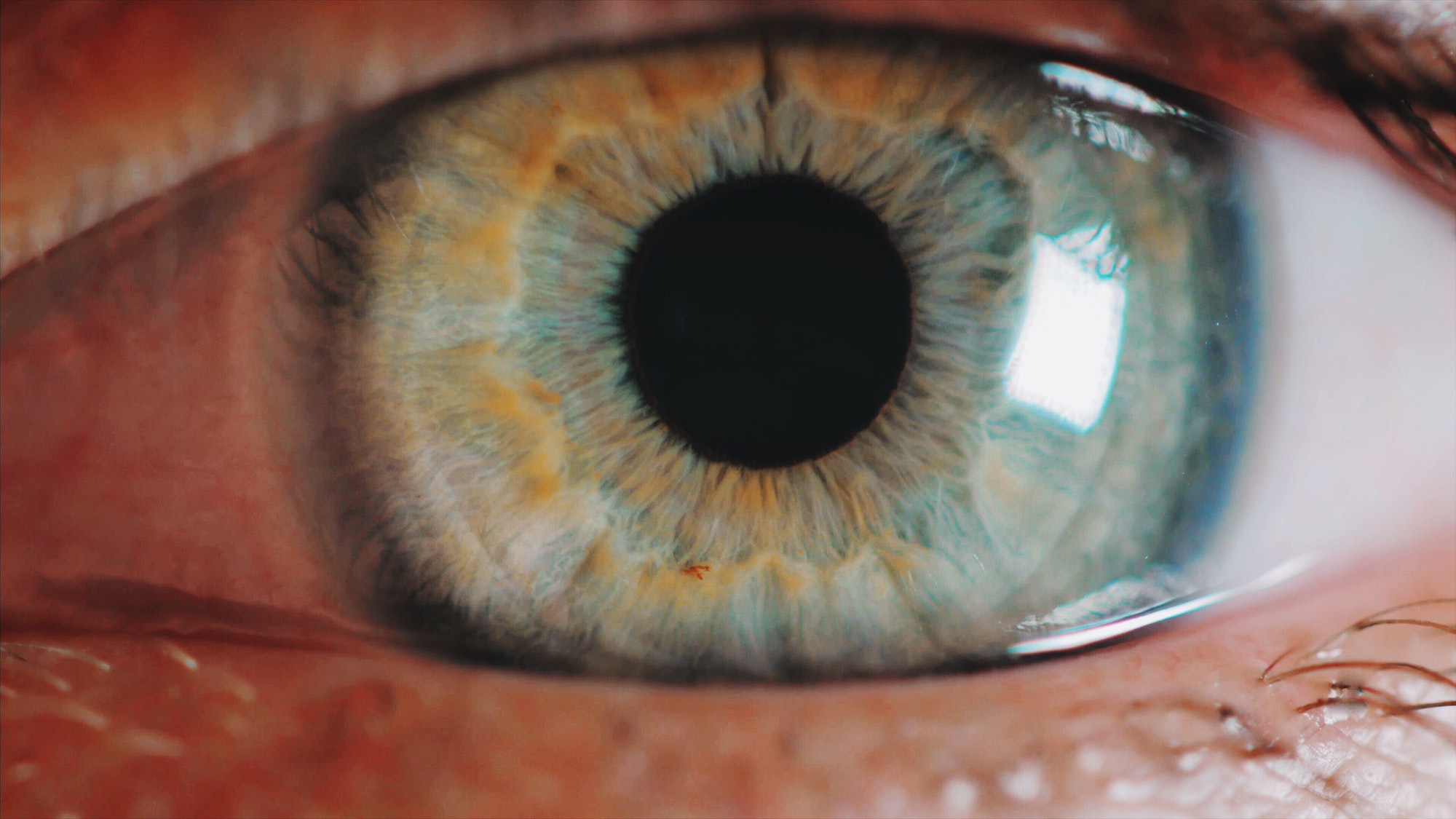 eye