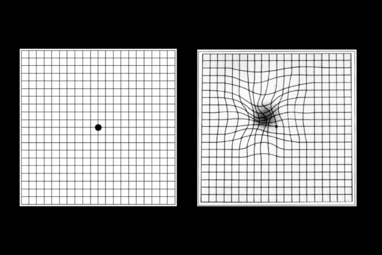 eye